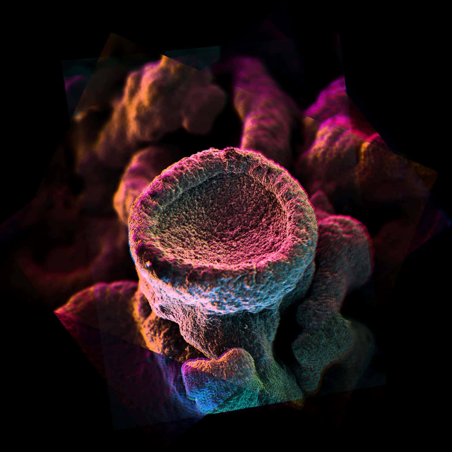 false-color scanning electron microscope image of lichen