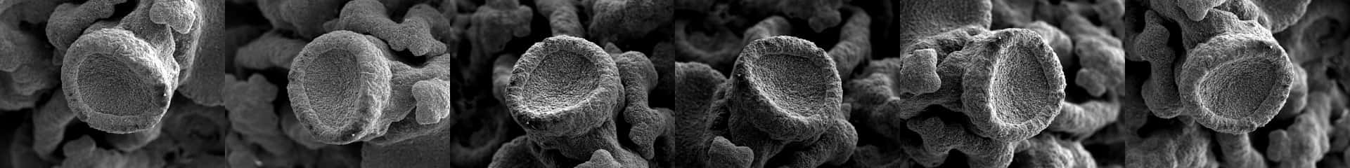 scanning electron microscope images of lichen from several angles