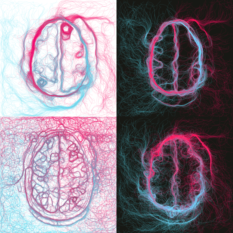 rough images of a brain formed from hundreds of organically wandering lines