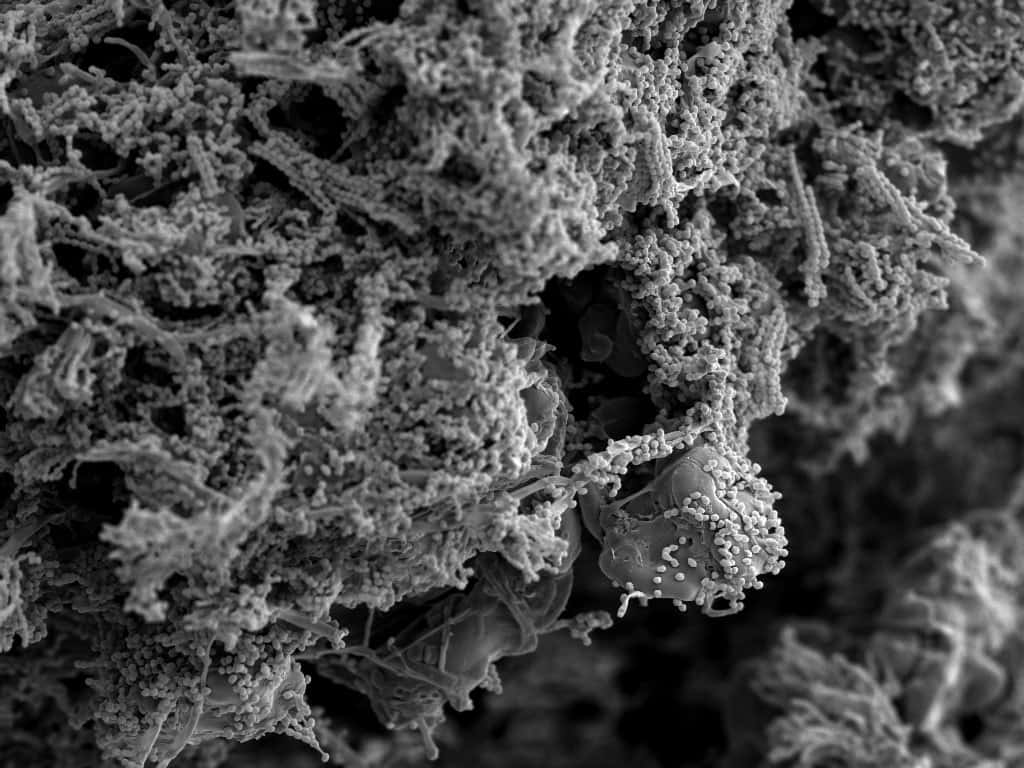 grayscale SEM image of bread mold